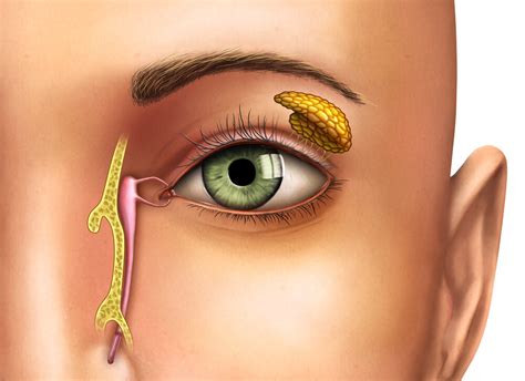 Lacrimal Punctum Swollen