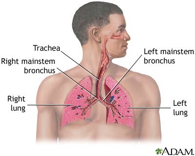 how to find out if you have pneumonia