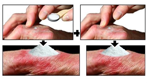 Soothe Skin Rashes with 10 Natural Home Remedies - UberSilk