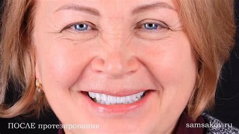 Закрытый кюретаж после удаления зуба мудрости: сроки, особенности ...