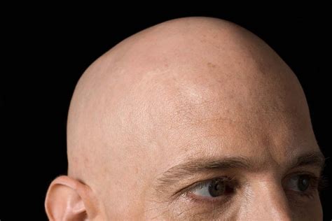 bald