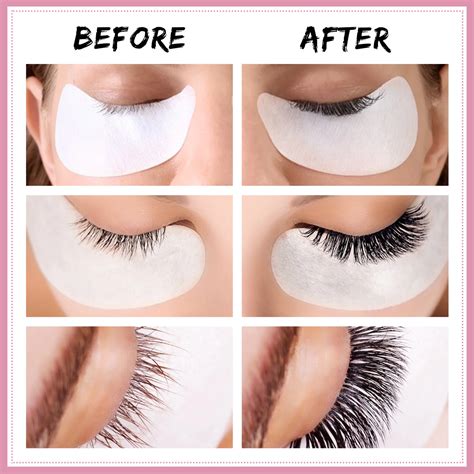 Aliver Hydrogel Eye Patch 100 pcs - Derma Roller Systems SA