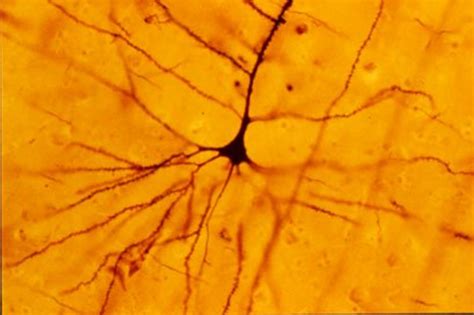 Structure of a Neuron | Owlcation