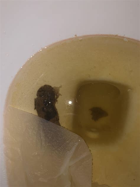 Is this blood? : r/poop