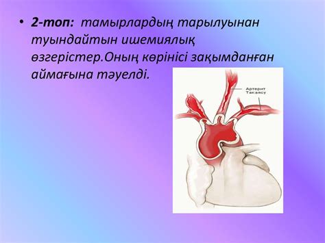 Такаясу ауруы - презентация онлайн