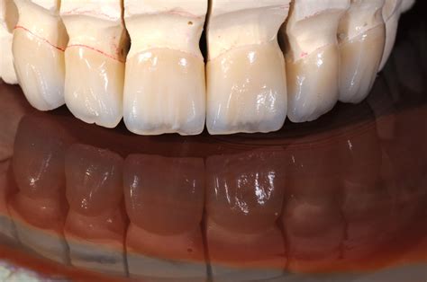 Fotogalerie – DentalAtelier Susanne Janz