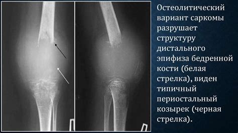 Рентгенологическое исследование костей и суставов - презентация онлайн ...