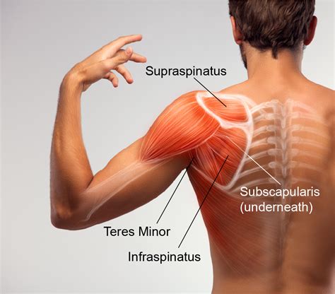 shoulder injury  pain  sci scire community