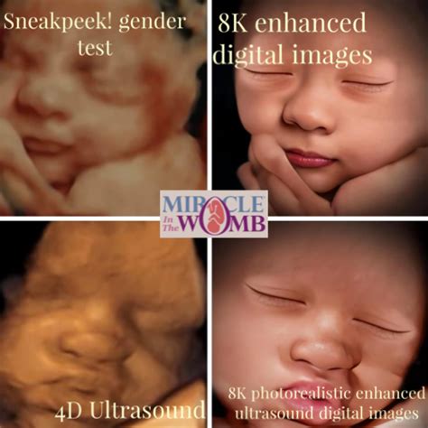 ultrasound hdlive book   ultrasound