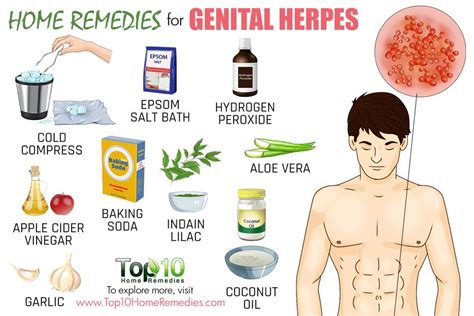 Como Curar A Herpes Genital - Home Remedies for Genital Herpes | Top 10 Home Remedies