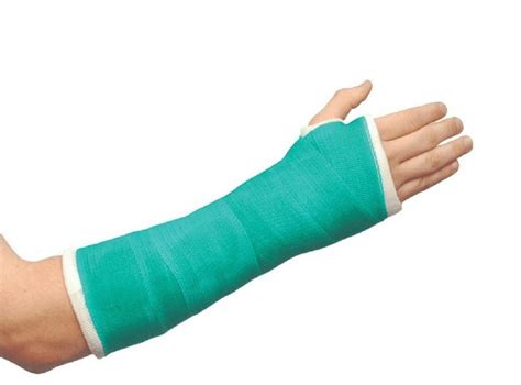 Waterproof casts - Hands On Hand Therapy NSW