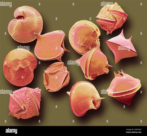 dinoflagellate protozoa coloured scanning electron micrograph sem