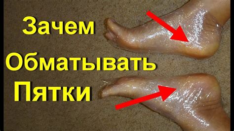 Потрясающий рецепт - гладкие мягкие пятки в домашних условиях за 1 день ...