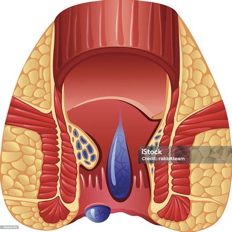 Trĩ Hình minh họa Sẵn có - Tải xuống Hình ảnh Ngay bây giờ - Biểu đồ ...