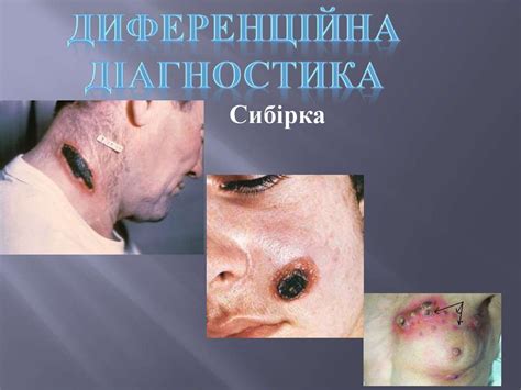 Чума - презентация онлайн