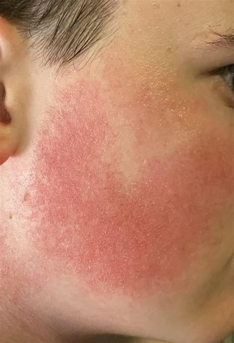I have been using BeyondKP for a month and this is the result (Info in