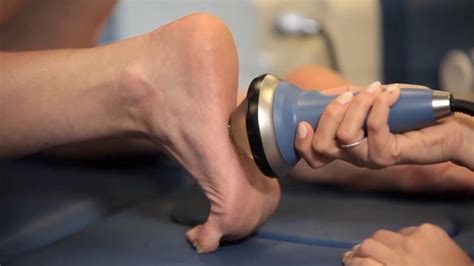 PiezoWave2 tratamiento fascitis plantar ondas de choque focal - YouTube