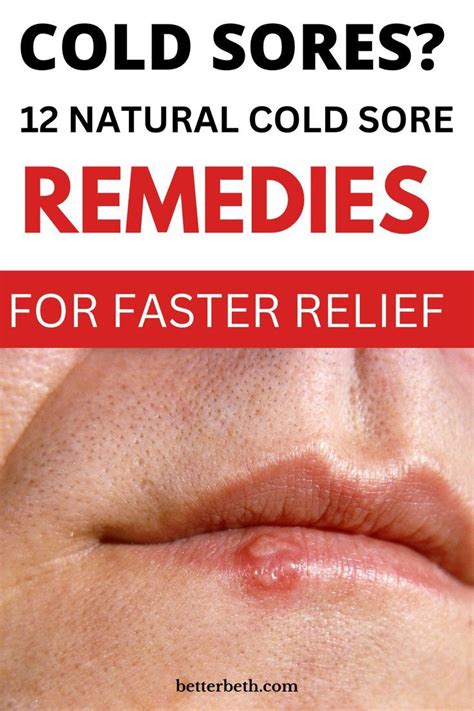 how to fix cold sore