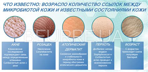 Oxy skin - купить в магазине BEURRE l Украина