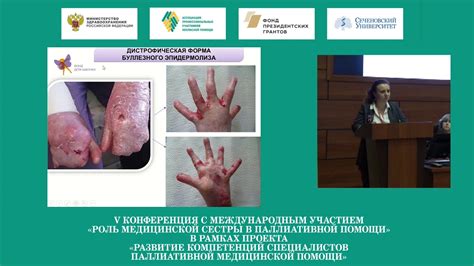 Уход за пациентом с буллезным эпидермолизом - YouTube