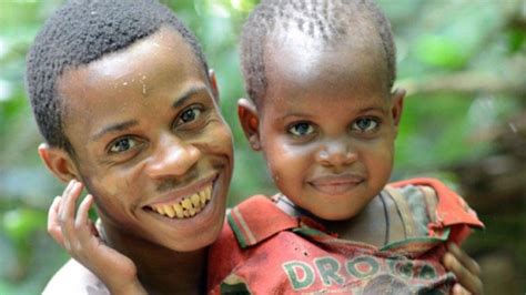 Pygmy People Teeth