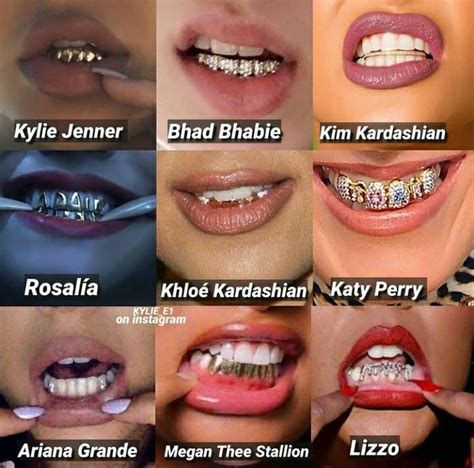 Gold Teeth Celebrity at Ganrayneblog Blog