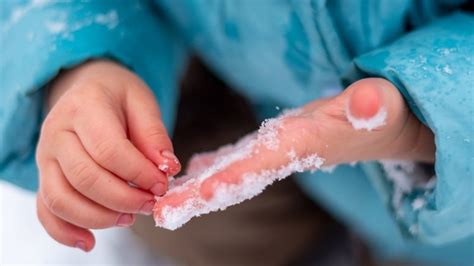 blisters caused  prevention  health