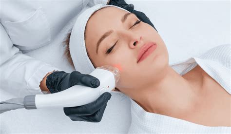 how much is it to get skin tags removed