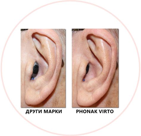 Мини слухов апарат - Избери своя модел от Ototon.bg