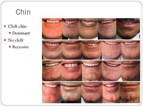 Is A Cleft Chin Dominant