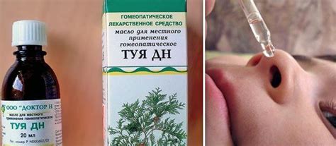 Масло туи при насморке у детей: инструкция, отзывы, при зеленых соплях