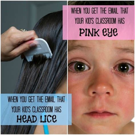 lice babies - pictures, photos