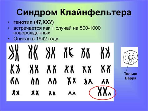 Наследственность и патологии. Хромосомные болезни. Лекция 7 ...