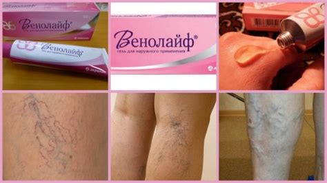 Гель Венолайф: инструкция по применению, цена, отзывы, аналоги