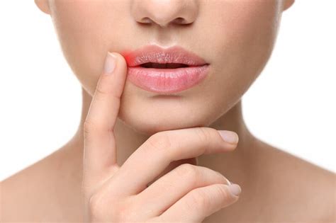 Как быстро избавится от герпеса на губах?