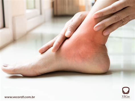 Tornozelos E Pés Inchados - Pés e tornozelos inchados podem indicar problemas circulatórios e ...