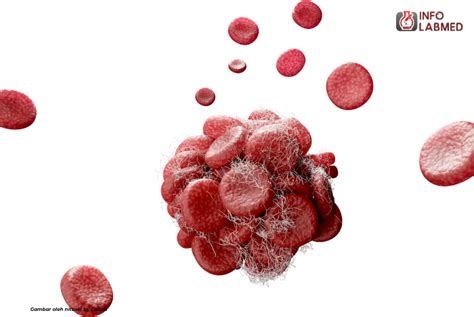 pemeriksaan cepat sampel darah solusi cepat  gangguan pembekuan darah