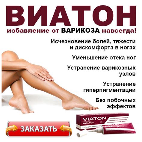 🧡ВИАТОН от варикоза. КУПИТЬ гель, отзывы, цена в России?