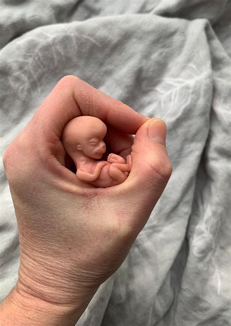 Week Old Fetus Miscarriage