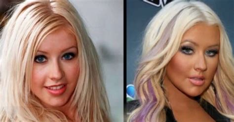 20 Most Influencing Best Plastic Surgery Before And After