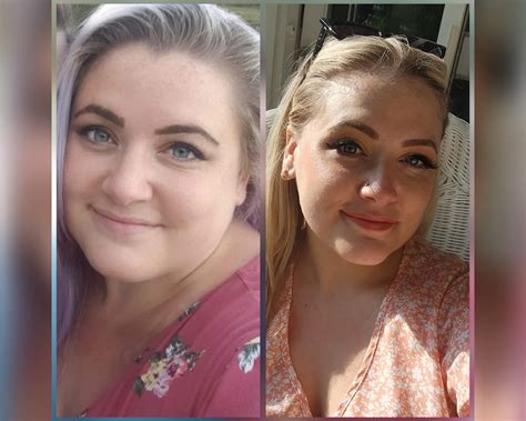 ozempic face celebrity 1