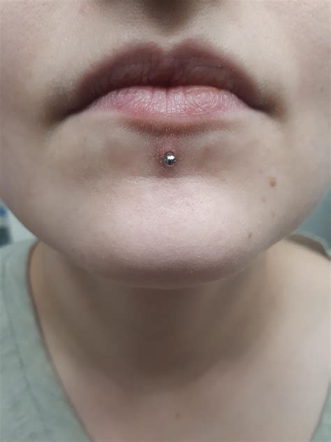 Lip Piercing Healed Over