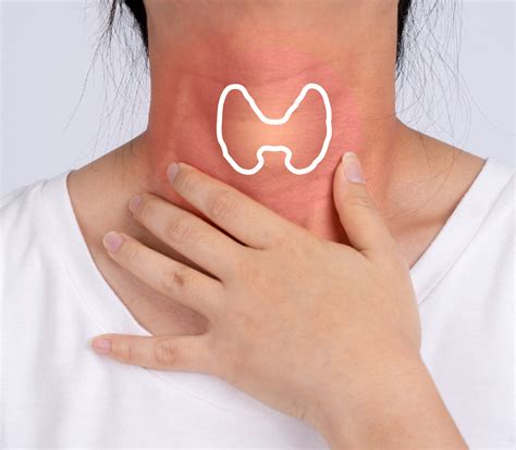When to Worry About Thyroid Nodules - Centre for Screening and Surgery