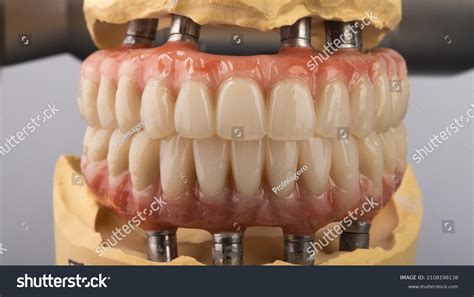 141 Upper four of tooth Images, Stock Photos & Vectors | Shutterstock