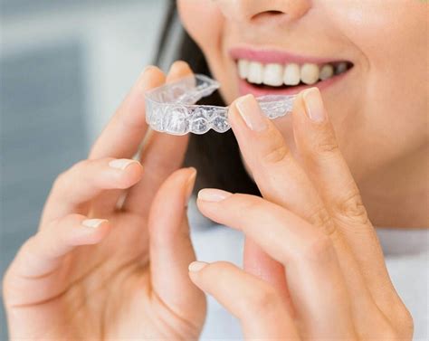clear aligners  invisalign  options    dental