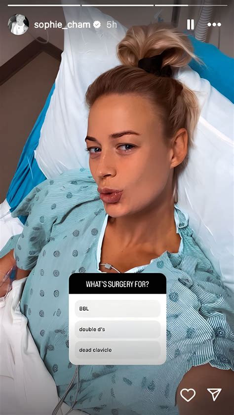 "BBL or Double Ds?": Sophie Cunningham poses cheeky surgery question