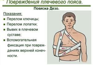Иммобилизация при переломах костей (алгоритм) | Медицинский справочник