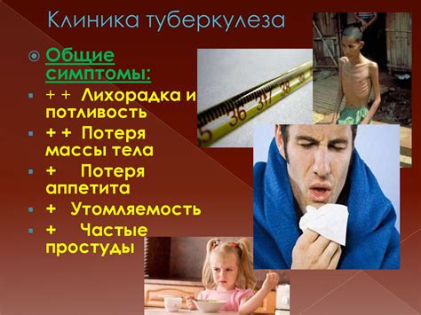 Профилактика туберкулеза - online presentation