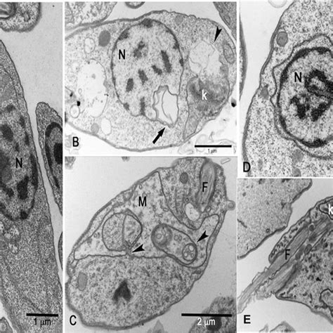 Transmission electron micrographs of Leishmania donovani. (A) General ...