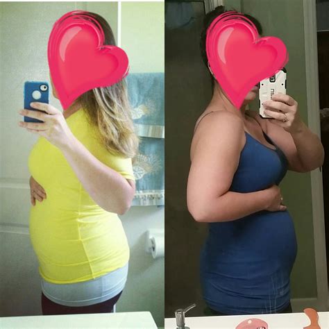 9 Weeks Pregnant Belly